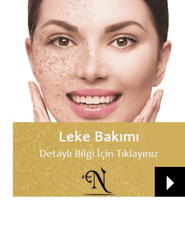 Leke Bakımı | Isparta Güzellik Merkezi