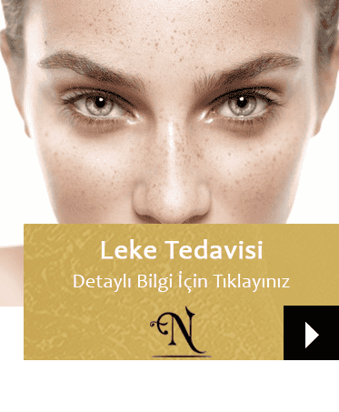 Leke Tedavisi | Isparta Güzellik Merkezi